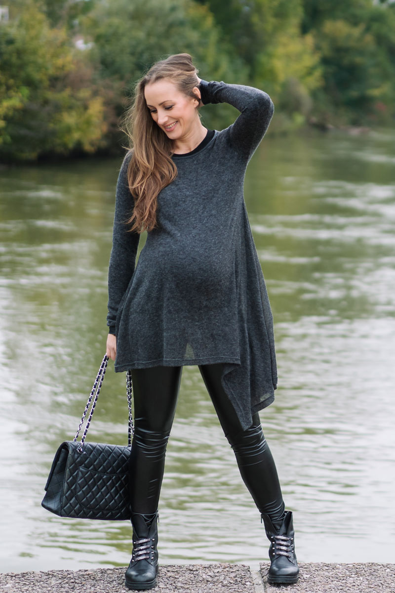 Nosečniške pajkice - videz usnja