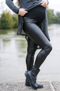 Nosečniške pajkice - videz usnja